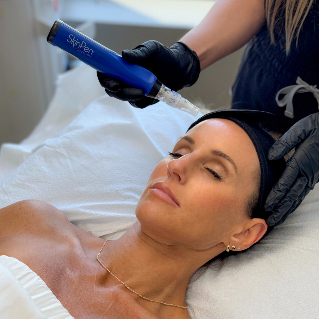 Microneedling & Botox Facials